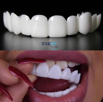 Blanco Elite 3D Premium - Snap-On Smile 😁✨ | ¡Di adiós a la vergüenza de sonreír!